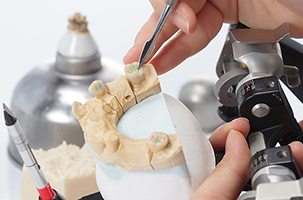 This image shows a person working with a 3D printer, using a small tool to manipulate an object that appears to be a partially printed model of a human tooth. The focus is on the process of creating dental implants through 3D printing technology.