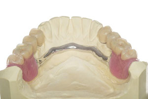 The image shows a 3D model of a human upper denture with artificial teeth arranged on a gum-like structure, set against a white background.